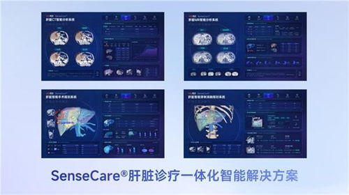 商湯醫(yī)療獲肝臟CT輔助診斷NMPA三類證，軟硬件零售賦能肝臟診療一體化新格局